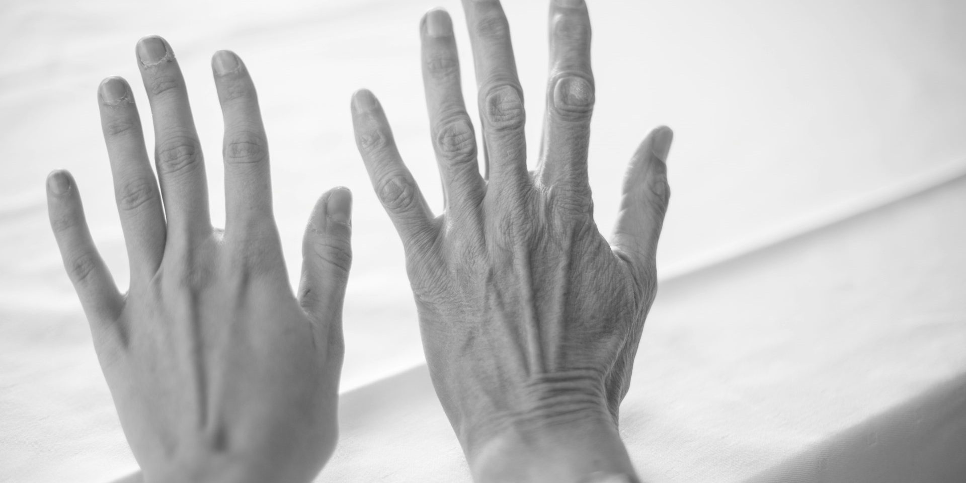 Vergelijking tussen jonge en oudere hand ter illustratie van huidveroudering en effect van tretinoïne crème